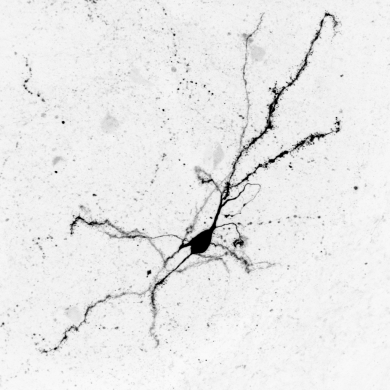 La neurona espinada
