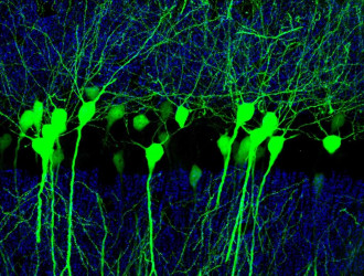 4 Neuronas excitadoras fluorescentes